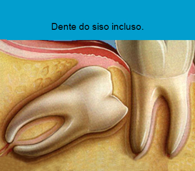 Cirurgia Bucomaxilofacial em Santos | São Vicente | Guarujá | Praia Grande | Canaan