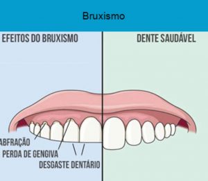 Clínica Odontológica em Santos | São Vicente | Guarujá | Praia Grande | Odontologia Canaan