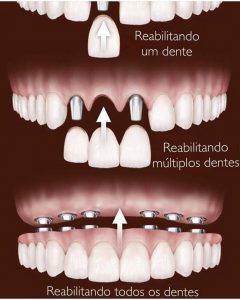 Clínica Odontológica em Santos | São Vicente | Guarujá | Praia Grande | Odontologia Canaan