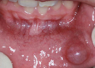 Cirurgia Bucomaxilofacial em Santos | São Vicente | Guarujá | Praia Grande | Odontologia Canaan