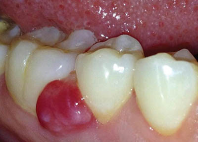 Cirurgia Bucomaxilofacial em Santos | São Vicente | Guarujá | Praia Grande | Odontologia Canaan