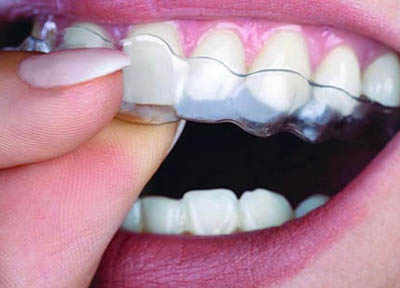 Ortodontista em Santos | São Vicente | Guarujá | Praia Grande | Odontologia Canaan